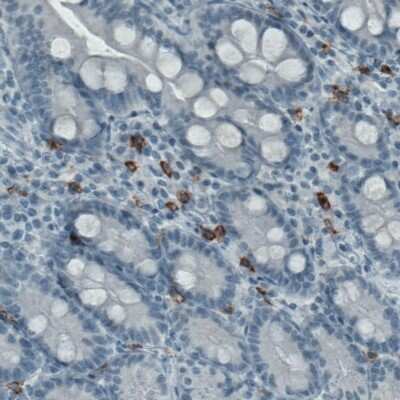 Immunohistochemistry-Paraffin: CD117/c-kit Antibody (CL1657) [NBP2-52975]