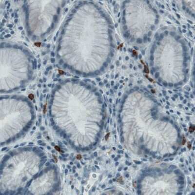 Immunohistochemistry-Paraffin: CD117/c-kit Antibody (CL1657) [NBP2-52975]