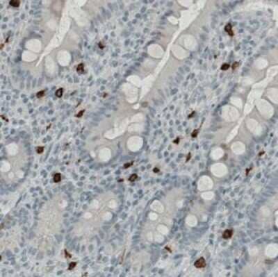 Immunohistochemistry-Paraffin: CD117/c-kit Antibody (CL1667) [NBP2-34487]