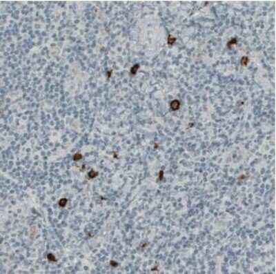 Immunohistochemistry-Paraffin: CD117/c-kit Antibody (CL1667) [NBP2-34487]