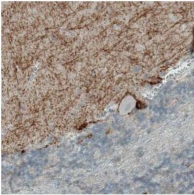 Immunohistochemistry-Paraffin: CD117/c-kit Antibody (CL1667) [NBP2-34487]