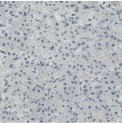 Immunohistochemistry-Paraffin: CD117/c-kit Antibody (CL1667) [NBP2-34487]