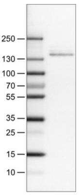 Western Blot: CD117/c-kit Antibody (CL1667) [NBP2-34487]