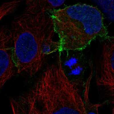 Immunocytochemistry/ Immunofluorescence: CD117/c-kit Antibody [NBP2-57890]