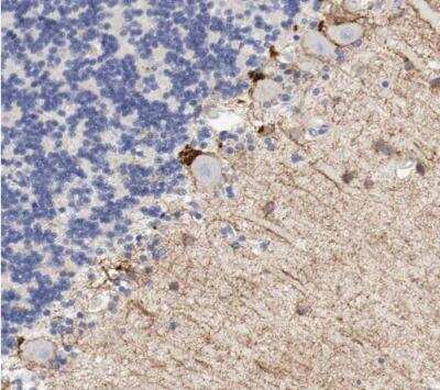 Immunohistochemistry-Paraffin: CD117/c-kit Antibody [NBP1-85593]