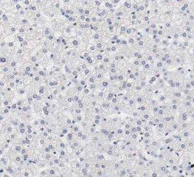 Immunohistochemistry-Paraffin: CD117/c-kit Antibody [NBP1-85593]