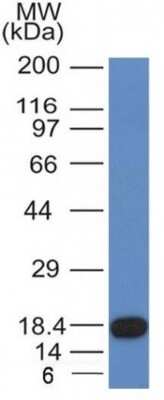 Western Blot: CD117/c-kit Antibody (KIT/982) [NBP2-44761]