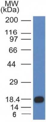 Western Blot: CD117/c-kit Antibody (KIT/983) [NBP2-44762]