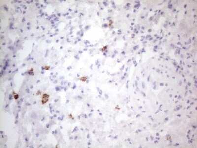 Immunohistochemistry: CD117/c-kit Antibody (OTI2B12) - Azide and BSA Free [NBP2-71076]