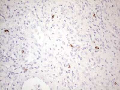 Immunohistochemistry: CD117/c-kit Antibody (OTI2B12) - Azide and BSA Free [NBP2-71076]