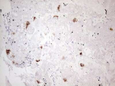 Immunohistochemistry: CD117/c-kit Antibody (OTI2B12) - Azide and BSA Free [NBP2-71076]