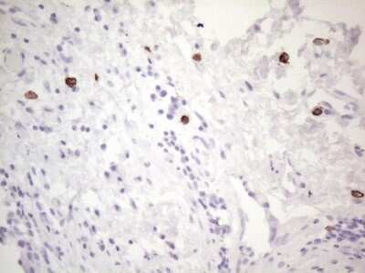 Immunohistochemistry: CD117/c-kit Antibody (OTI2B12) - Azide and BSA Free [NBP2-71076]