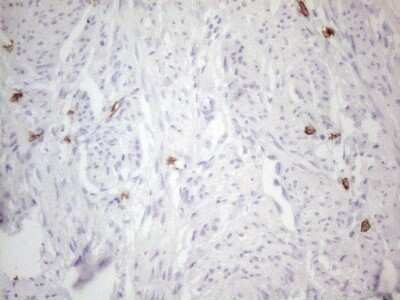 Immunohistochemistry: CD117/c-kit Antibody (OTI2B12) - Azide and BSA Free [NBP2-71076]