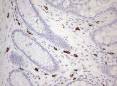 Immunohistochemistry-Paraffin: CD117/c-kit Antibody (OTI2B12) - Azide and BSA Free [NBP2-71076]