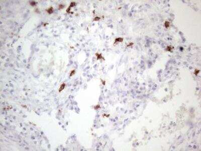 Immunohistochemistry-Paraffin: CD117/c-kit Antibody (OTI2B12) - Azide and BSA Free [NBP2-71076]