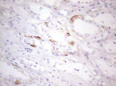 Immunohistochemistry-Paraffin: CD117/c-kit Antibody (OTI2B12) - Azide and BSA Free [NBP2-71076]