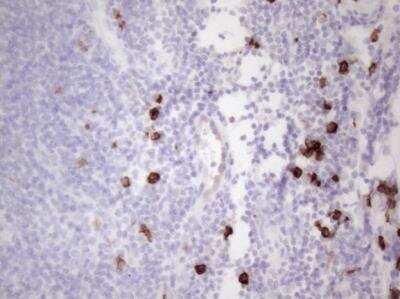 Immunohistochemistry-Paraffin: CD117/c-kit Antibody (OTI2B12) - Azide and BSA Free [NBP2-71076]