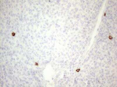 Immunohistochemistry-Paraffin: CD117/c-kit Antibody (OTI2B12) - Azide and BSA Free [NBP2-71076]
