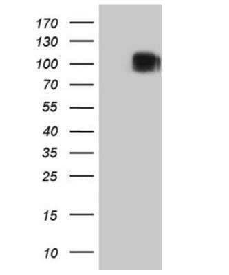 Western Blot: CD117/c-kit Antibody (OTI2B12)Azide and BSA Free [NBP2-71076]