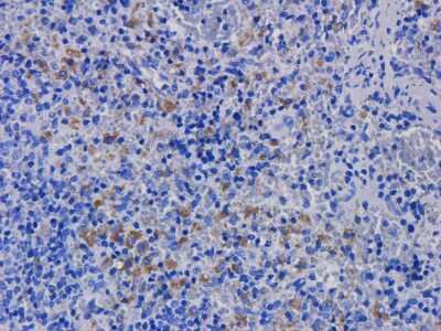 Immunohistochemistry: CD11a/CD18 Antibody (hu1124 (Efalizumab)) - Chimeric - Azide and BSA Free [NBP2-52686]