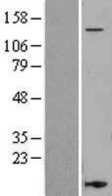 Western Blot: Integrin alpha L/CD11a Overexpression Lysate [NBL1-12068]