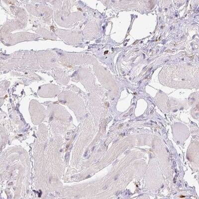 Immunohistochemistry-Paraffin: CD11b Antibody (CL1719) [NBP2-34490]