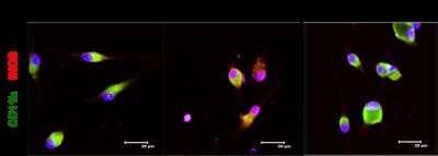 Immunocytochemistry/ Immunofluorescence: CD11b Antibody (M1/70.15) - Azide and BSA Free [NBP2-80626]