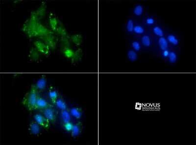 Immunocytochemistry/ Immunofluorescence: CD11b/c Antibody - BSA Free [NB110-40766]