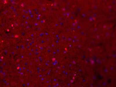 Immunohistochemistry-Frozen: CD11b/c Antibody - BSA Free [NB110-40766]