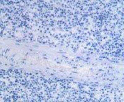 Immunohistochemistry-Paraffin: CD11c Antibody (AP-MAB0806) - Azide and BSA Free [NB110-97871]