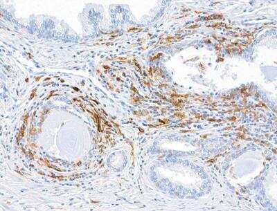 Immunohistochemistry: CD11c Antibody (BLR138H) [NBP3-14718]