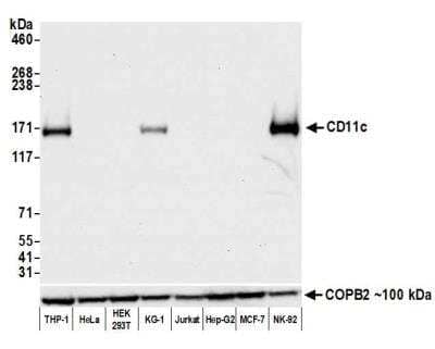 Western Blot: CD11c Antibody (BLR138H) [NBP3-14718]