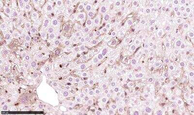 Immunohistochemistry-Paraffin: CD11c Antibody (CL1831) [NBP2-34491]