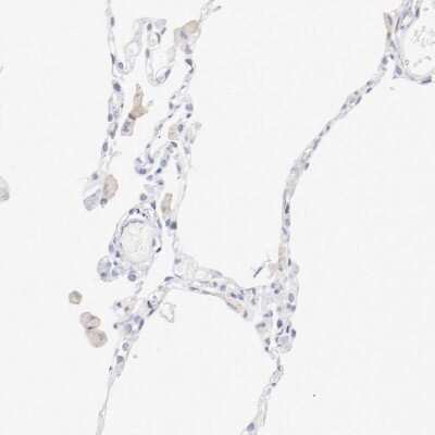 Immunohistochemistry-Paraffin: CD11c Antibody [NBP1-91210]