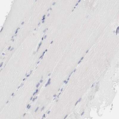 Immunohistochemistry-Paraffin: CD11c Antibody [NBP1-91210]