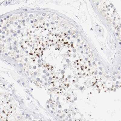 Immunohistochemistry-Paraffin: CD11c Antibody [NBP1-91210]