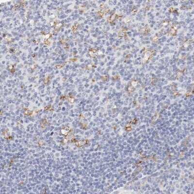 Immunohistochemistry-Paraffin: CD11c Antibody [NBP1-91210]