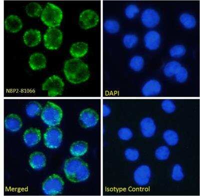 Immunocytochemistry/ Immunofluorescence: CD11c Antibody (N418) - Chimeric - Azide and BSA Free [NBP2-81066]