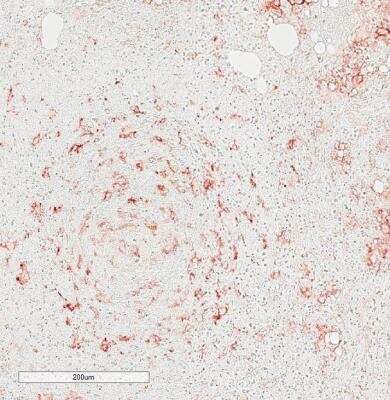 Immunohistochemistry-Paraffin: CD11c Antibody (SI19-06) [NBP2-67402]