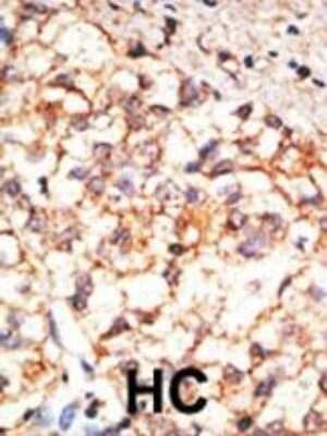 Immunohistochemistry-Paraffin: CD133 Antibody - BSA Free [NB120-16518]