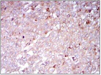 Immunohistochemistry-Paraffin: CD133 Antibody (3F10) - BSA Free [NBP2-37741]