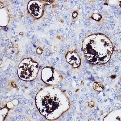 Immunohistochemistry-Paraffin: CD133 Antibody (3Y4A5) [NBP3-15310]
