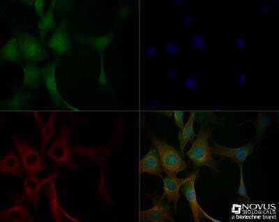 Immunocytochemistry/ Immunofluorescence: CD133 Antibody - BSA Free [NBP2-44250]