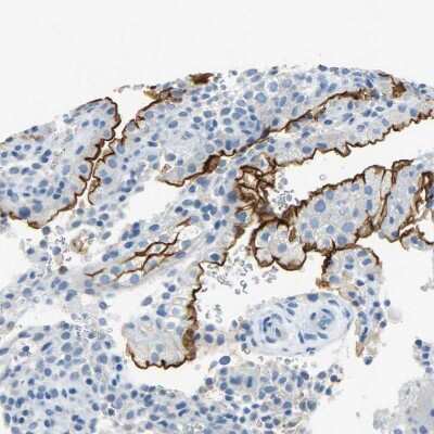 Immunohistochemistry-Paraffin: CD133 Antibody [NBP2-59787]