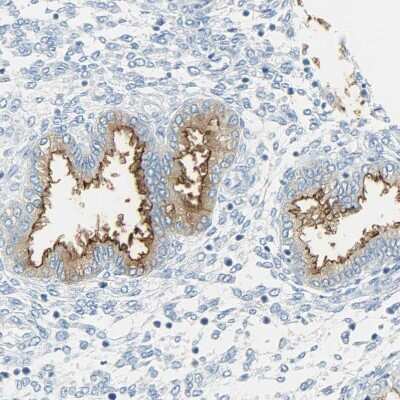 Immunohistochemistry-Paraffin: CD133 Antibody [NBP2-59787]
