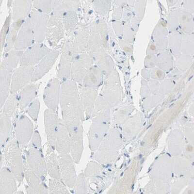 Immunohistochemistry-Paraffin: CD133 Antibody [NBP2-59787]
