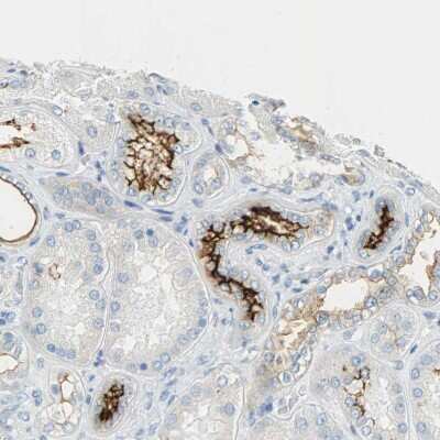 Immunohistochemistry-Paraffin: CD133 Antibody [NBP2-59787]