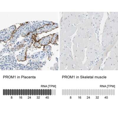 Immunohistochemistry-Paraffin: CD133 Antibody [NBP2-59787]