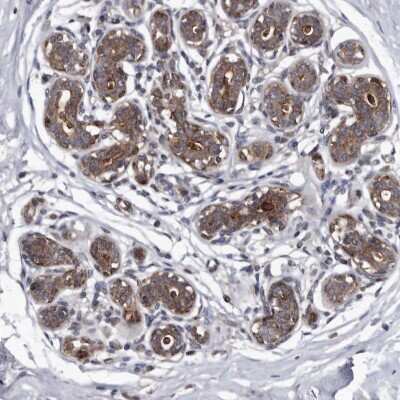 Immunohistochemistry-Paraffin: CD133 Antibody [NBP2-59789]