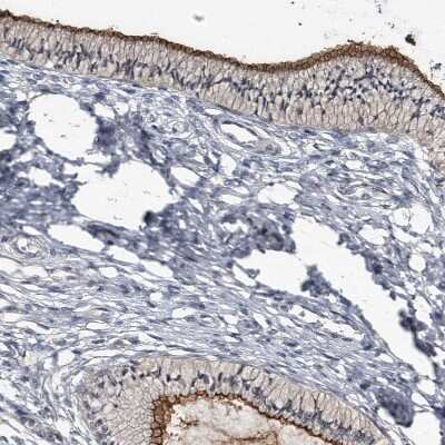 Immunohistochemistry-Paraffin: CD133 Antibody [NBP2-59789]